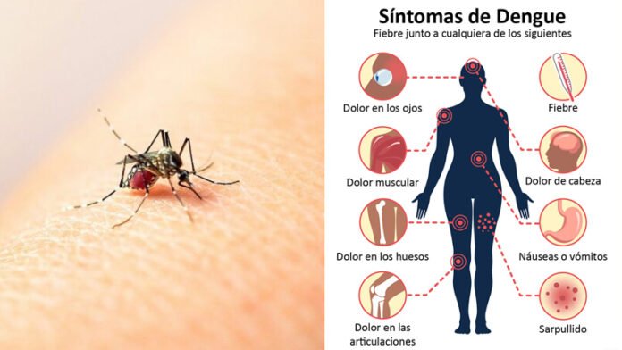 Dengue Cuáles Son Los Síntomas Y Cuánto Tardan En Aparecer Impacto Local